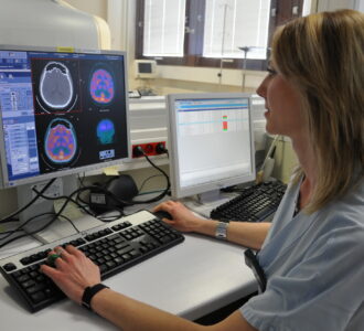 Image de Pet scan du cerveau