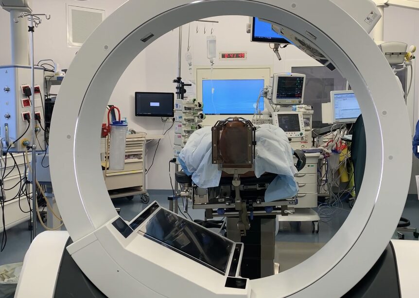 Stimulation cérébrale profonde